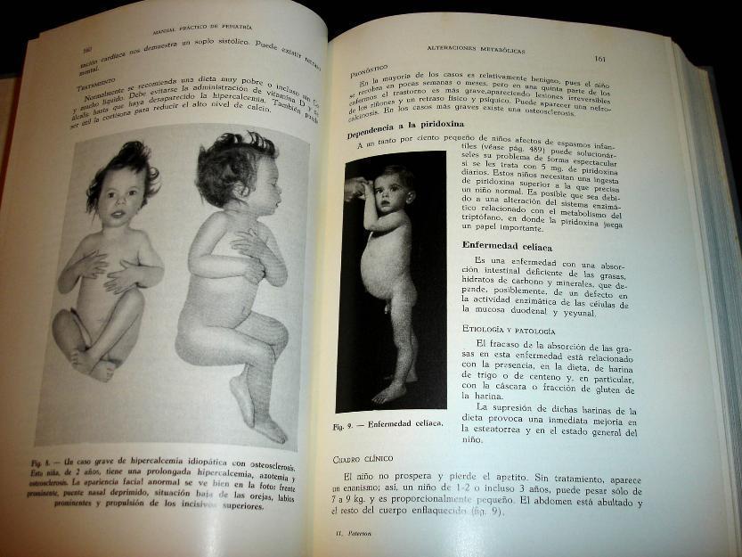 Antiguo Manual de Pediatria -ilustrado-1968