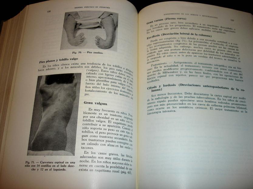 Antiguo Manual de Pediatria -ilustrado-1968