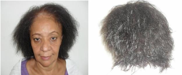 INOAR - Keratina Brasileña - G - Hair (escova Alemã) SEM FORMOL