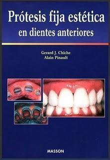 Protesis Fija Estetica En Dientes Anteriores de Gerard J. Chiche - Libro